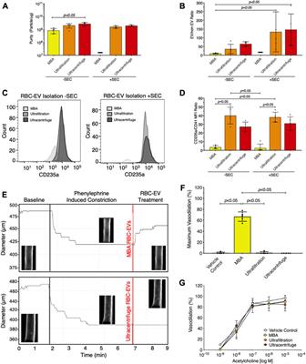 Mechanical stimuli such as shear stress and piezo1 stimulation generate red blood cell extracellular vesicles